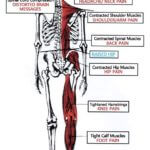 Misaligned Spine