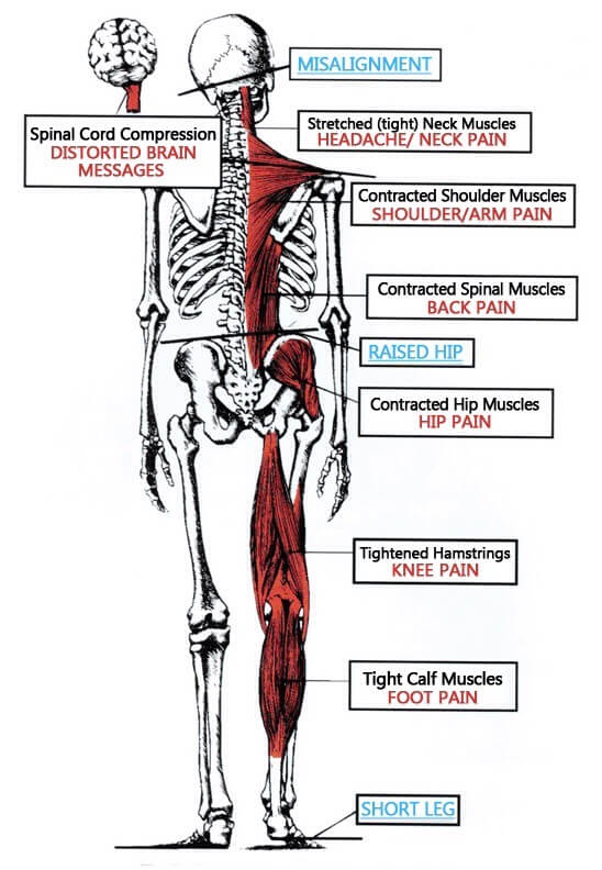 Is My Upper Spine Misaligned Chiropractor Eatontown NJ