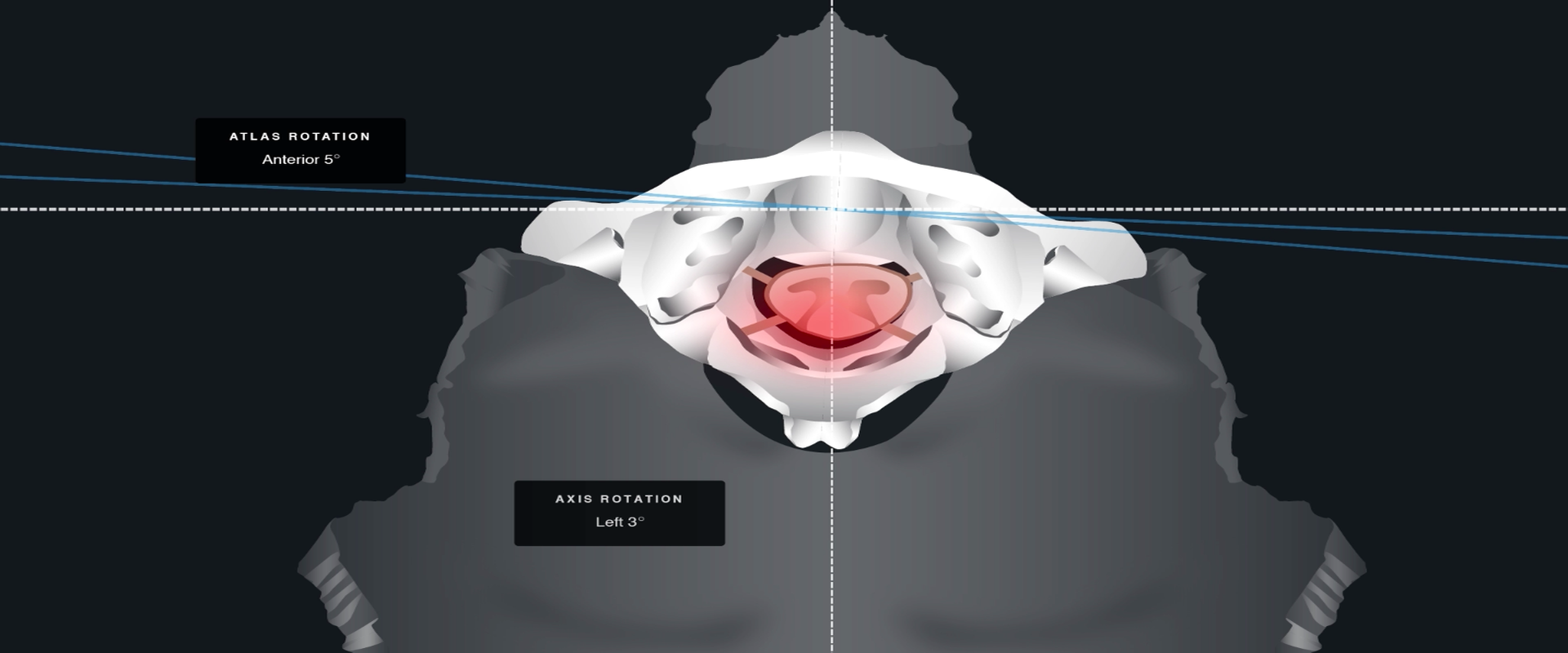 Molland Spinal Care - NUCCA Upper Cervical Chiropractic of NJ